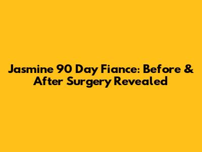Jasmine 90 Day Fiance: Before & After Surgery Revealed