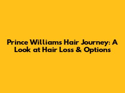 Prince William's Hair Journey: A Look at Hair Loss & Options
